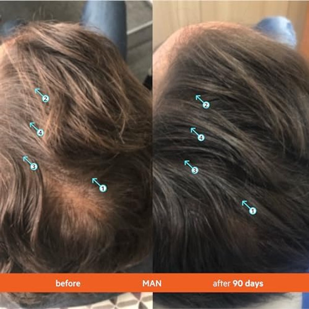 Ds Laboratories Revita Shampoo & Vitamin Tablets For Thicker Hair Growth Dht Blocker & Biotin Hair Thickening Products For Men & Women