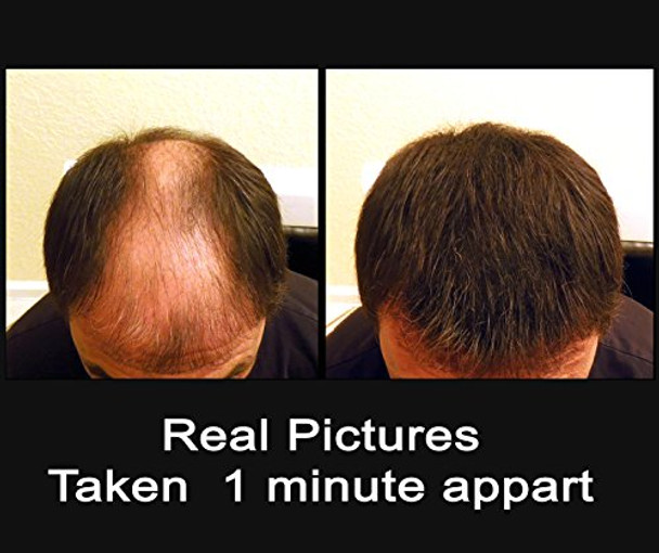 Keratin Research Black 100 Grams Super Size Original Samson Hair Building Fibers Refill For All Brands