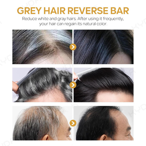 Kyda 3Pcs Gray Hair Reverse Bar Soap Black Shampoo Bar For Hair And Beard Darkening Deep Clean And Nourish The Scalp Black Soap For Gray Hair Coverage Natural Darkening Shampoo Soap