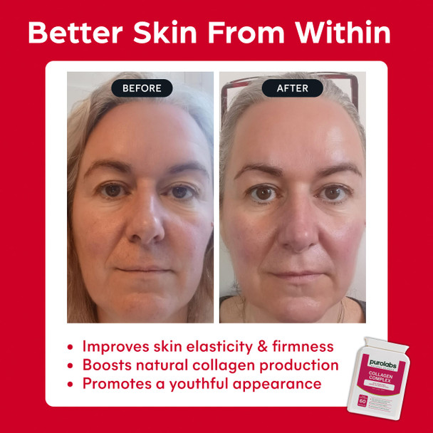 Purolabs Marine Collagen Complex - Collagen Supplement for Women & Men - with Hyaluronic Acid & Vitamin C - High Strength Type 1 Hydrolyzed Collagen Peptides - 60 Capsules