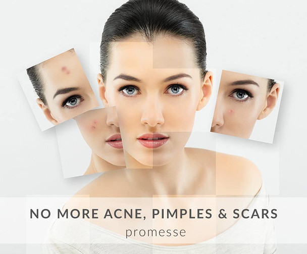 promesse Acne Control Facial Cleanser - Anti-Aging Exfoliating Wash with Glycolic & Salicylic Acid, Grapefruit - 4 fl oz