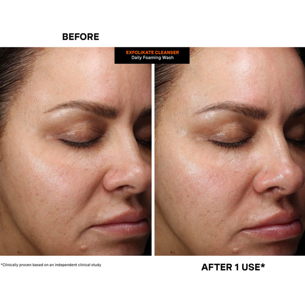 Kate Somerville ExfoliKate Cleanser – Daily Exfoliating Foaming Face Wash – Clinically Formulated Glycolic Acid and Lactic Acid Gentle Facial Scrub -4 Fl Oz