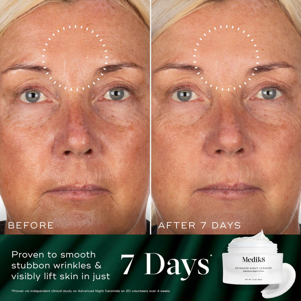 Medik8 Overnight Renewal Kit - Advanced Liquid Peptides Face Serum with Hyaluronic Acid - Ceramide Face Moisturizer Hydrates Skin - 3 pc