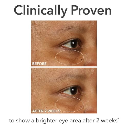 Dr Dennis Gross Derminfusions Fill + Repair Eye Cream: Hydrating & Brightening Treatment For Dark Circles Fine Lines & Wrinkles Firms & Smooths 360Ãƒšã‚° Eye Area 0.5 Oz