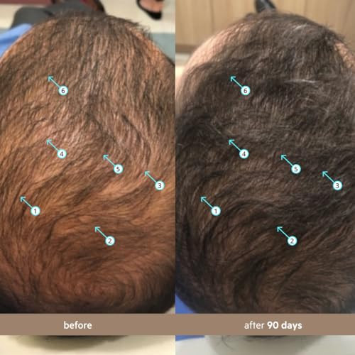 Ds Laboratories Spectral Menãƒ¢Ã¢Š¬Ã¢Ž¢S Hair Density Serum (Formerly Spectral.Dnc-N) 60Ml - Lightweight Leave In For Fuller Looking Thicker Looking Hair Fast Absorbing Non-Greasy For All Hair Types (3 Pack)