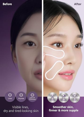 Dweasyderm Easyderm Pdrn Patch - Under Eye & Smile Line Care 4 Patches K-Beauty Korean Skincare With Collagen & Egf Smile Lines Treatment Pdrn Eye Mask Special Care Stocking Stuffer Holiday