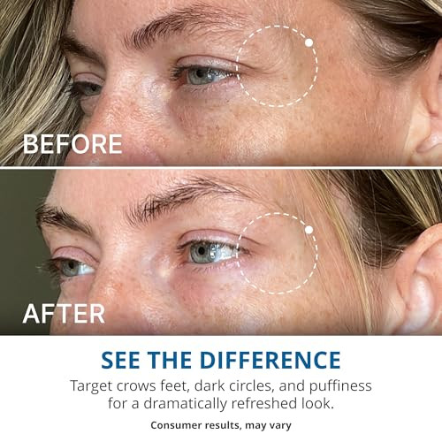 Gopure Advanced Repair Eye Cream - Under Eye Cream For Puffiness Bags And Dark Circles Visibly Improve The Look Of Fine Lines Wrinkles And Crows Feet - 0.57 Fl Oz