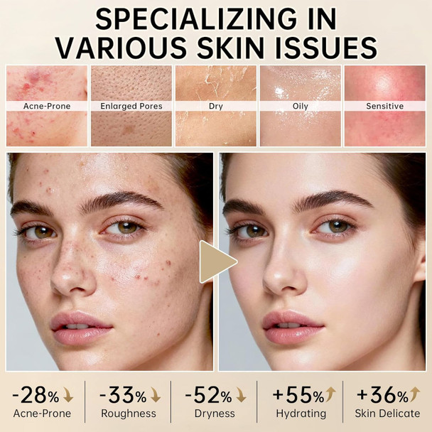 Kiuoret Avocado Skin Care Set - 11Pcs Skincare  Set With Facial Cleanser Toner Serum Eye Cream Lotion Face Cream And Moisturizing Facial Masks - Korean Skin Care Kit For All Skin Types