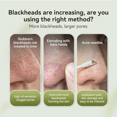Lanbena Blackhead Mask Nose Plants Pores Strips Blackhead Remover Mask Peel Off Mask Facial Pore Cleanser Purifying Face Mask Nose Strips (1.06 Ounce) - White