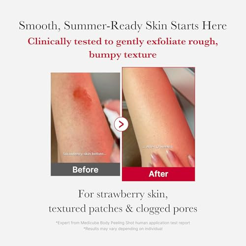 Medicube Red Body Peeling Shot Aha + Bha Exfoliating Body Spray For Summer-Ready Smooth Skin Treats Strawberry Skin Bumps & Breakouts 3.88 Oz