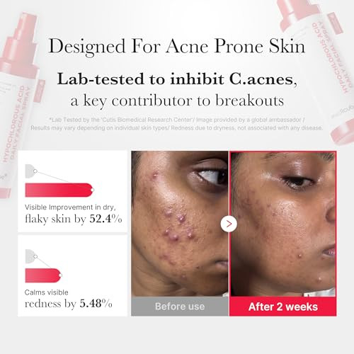 Medicube Red Power Duo For After Spot Care Use: Txa+Niacinamide 15% Glow Facial Serum And Power Soothing Spray