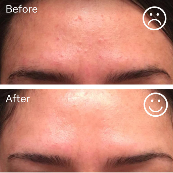 Nuorganic Cosmeticsface Lifting Serum With Plant Stem Cells & Matrixyl 3000 - Advanced Anti-Aging To Minimize Fine Lines & Wrinkles - Vegan & Cruelty  (1Fl Oz)