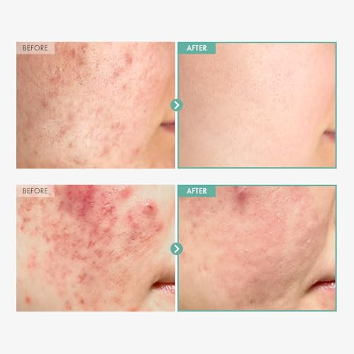 Tosowoong Dexpanthenol Cream 170000Ppm B5 Panthenol Madecassoside Centella Asiatica For Skin Barrier Repair Facial Moisturizer Soothing Hydrating Korean Skincare 60Ml 2.02 Fl. Oz.