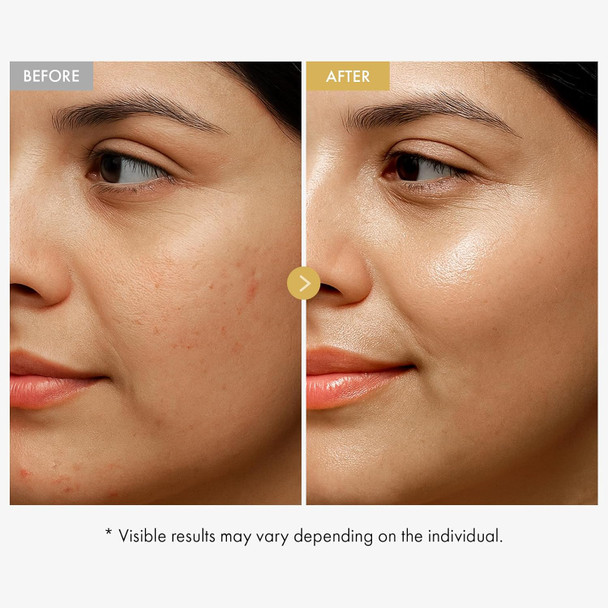 Tosowoong Arbutin 7% + Tranexamic Acid 4% Cream 70000Ppm Arbutin 40000Ppm Txa Niacinamide Glutathione Dark Spots Freckle Blemishes Pigmentation Korean Skin Care 50Ml 1.69 Fl.Oz.