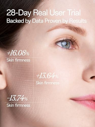 Wnp Gentle Retinol Cream For Sensitive Skin 10Ãƒæ’Ã¢‚¬Deep Transdermal Night Cream Anti-Aging Face & Neck Moisturizer With Ceramides Peptides Pro-Xylane Wrinkle Cream For Fine Lines Firming Hydrating