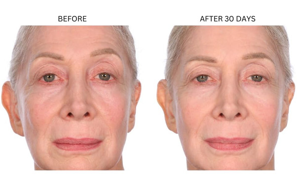 Consult Beaute Xterna-Q Anti-Aging Universal Day And Night Coq10 Cream - Peptide Q10 & Niacinamide Face Moisturizer For Dry Skin - Restore Skin Barrier - Visibly Reduce Lines & Wrinkles - 1 Fl Oz