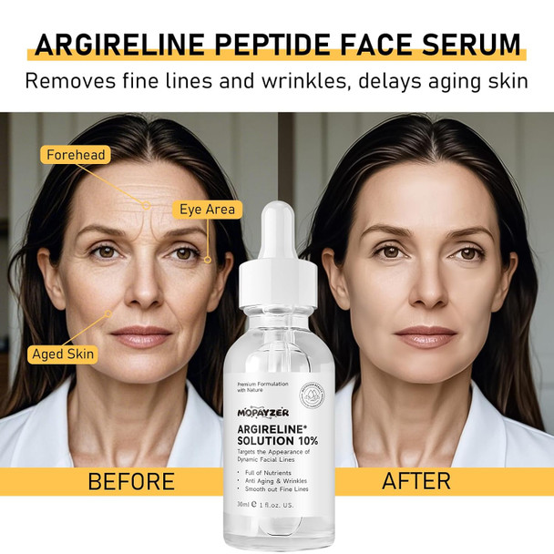 Mopayzer Argireline Serum For Oily Skin Advanced Anti-Wrinkle Facial Serum For Women 30 Ml/ 2 Pcs Moisturizing Argireline 10% Solution For Face Argireline Peptide.
