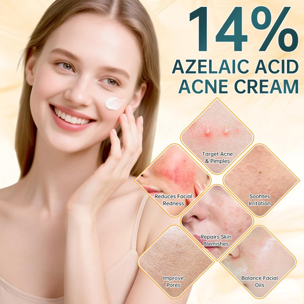 Mopayzer Azelaic Acid 14% For Face Premium Acne Cream Reduces Dark Spots & Facial Redness Azelaic Acid Serum With Salicylic Acid & Niacinamide For Acne Breakouts Oil Control & Relieve Irritation 1 Oz