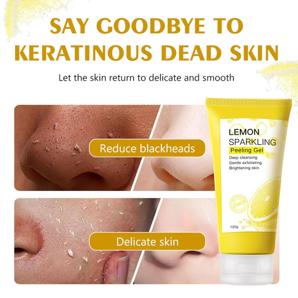 Omexry Lemon Sparkling Peeling Gel Lemon Face Scrub Exfoliator Facial Peel Gel For Face And Body Purifying Exfoliating Gel Korean Skincare For Women Men (2Pc)