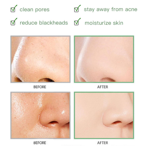 Omexry Mugwort Clay Mask Mugwort Mask Centella Clay Mask Stick Clay Stick Mask For Face Acne & Blackhead Remover Mask Green Clay Mask For All Skin Types (2Pc)