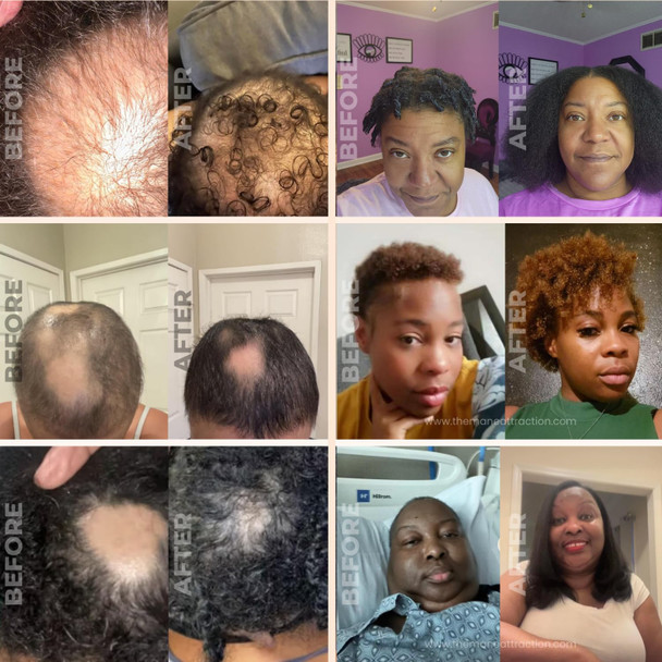 The Mane Attraction Hair Oil For All Hair Types Infused With Rosemary Oil Castor Oil & Black Seed Oil - Stimulating Hair Growth Seals In Moisture Soothes Irritated Scalp. Mini 2Oz