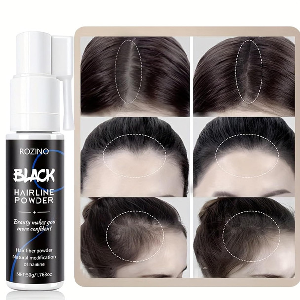 Xiaoks Hairline Powder For Women Men 360Ã‚° Rotating Nozzle Instant Root Cover Up Natural Looking Hair Thickening Fibers Smudge Proof & Water Resistant Easy To Use For Thinning Hair Edges & Crown (Black)