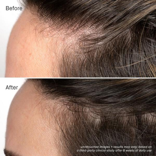 isima Iconic Densifying Scalp Serum