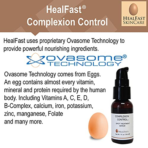 HealFast Complexion Control Spot Treatment Serum 1 Oz – For Acne and Scar of Face and Body – Blemish Remover For All Skin Types – Formulated with Salicylic Acid Using Ovasome Technology