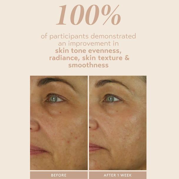 SHANI DARDEN SKIN CARE Retinol Reform with 1% Encapsulated Retinol Serum for Face & Neck Gentle Slow-Release Retinol Face Serum with Tripeptide for Wrinkles Fine Lines & Uneven Tone 0.3 fl oz