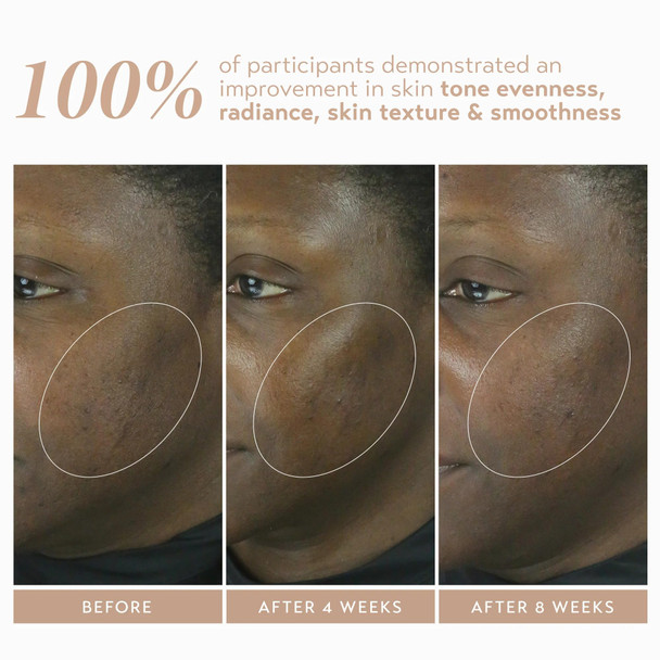 SHANI DARDEN SKIN CARE Retinol Reform with 1% Encapsulated Retinol Serum for Face & Neck Gentle Slow-Release Retinol Face Serum with Tripeptide for Wrinkles Fine Lines & Uneven Tone 0.3 fl oz