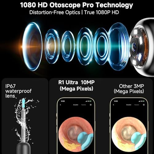 Bebird R1 Ultra Ear Wax Removal Ear Cleaner With Camera Ear Scope Wax Remove Ear Pick With Ear Otoscope Tweezers Visual Dropper Cleaning Kit Ear/Nose/Throat Examination Tool For Family