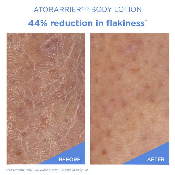 AESTURA ATOBARRIER365 Korean Body Lotion with Ceramides | Fast-Absorbing Moisturizer for Dry Sensitive & Eczema-Prone Skin | Non-Comedogenic Fragrance-Free 400 mL / 13.5 fl oz