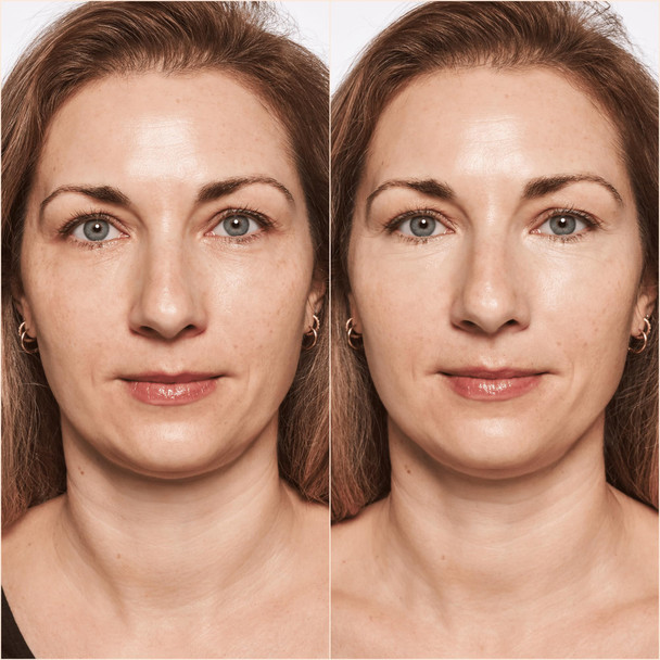 Catrice | True Skin High Cover Concealer (002 | Neutral Ivory) | Waterproof & Lightweight for Soft Matte Look | With Hyaluronic Acid & Lasts Up to 18 Hours | Vegan Cruelty Free