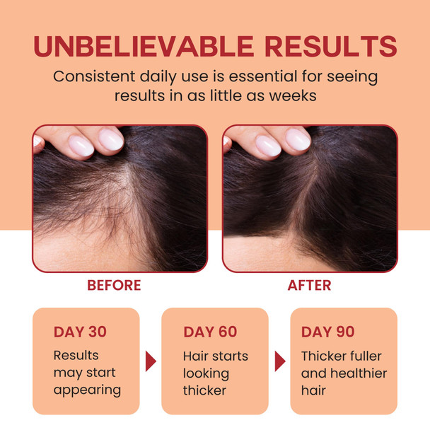 Lebanta Raw Batana Oil for Hair Growth - 100% Pure Organic 4oz