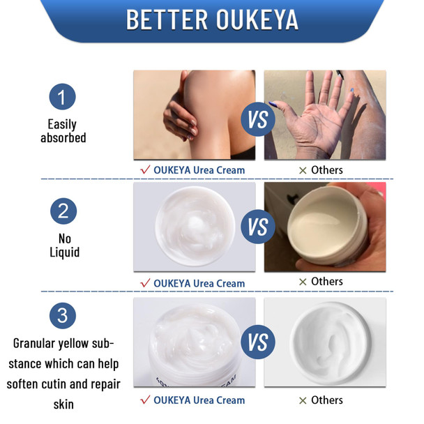 OUKEYA Urea Cream 40 Percent Foot & Hand Cream for Dry Cracked Urea Lotion for Feet Maximum Strength  5.29Oz