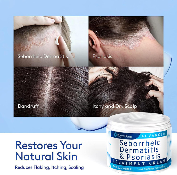 Roycederm Seborrheic Dermatitis Cream Scalp Treatment for Psoriasis Folliculitis Dry Scalp Dandruff Anti-Itch Cream for Soothing Relief  100 ML