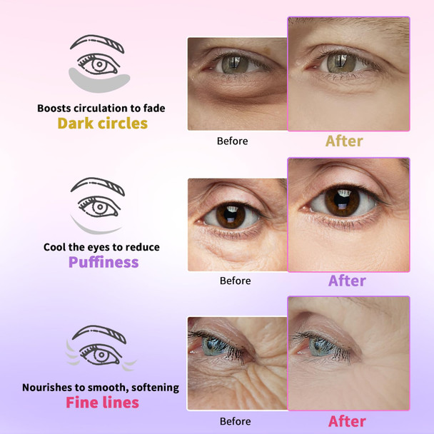 Under Eye Patches for Dark Circles Puffiness Fine Lines Eye Mask Set with Retinol 24K Gold Caffeine Gel Mask for Birthday & Spa Party Favors Skincare Gift for Women & Men 24 Pairs