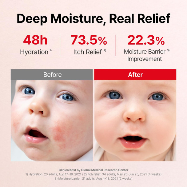 ATOPALM  MLE Eczema Cream Premium Baby Lotion Newborn Baby Face and Body Moisturizer for Skin Barrier Moisturizing Facial Cream for Itchiness & Redness Korean Skincare 2.2 fl oz (65ml)