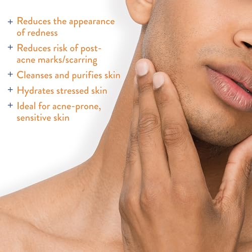 Acnefree Hypochlorous Acid Soothing Spray For Face & Body Redness Relief Mist For Acne-Prone Sensitive Or Irritated Skin Gentle Daily Spray For Breakout Support & Skin Barrier Balance 4 Ounce