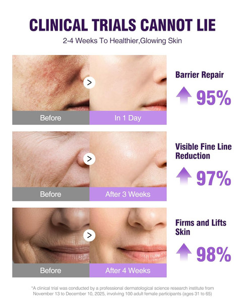 Biysber Nad+ Retinol Collagen Serum For Face: Anti-Aging Peptide Serum Tightens Skin Reduces Wrinkles & Fine Lines Hydrating Serum For Radiant Glow 1.7 Fl.Oz