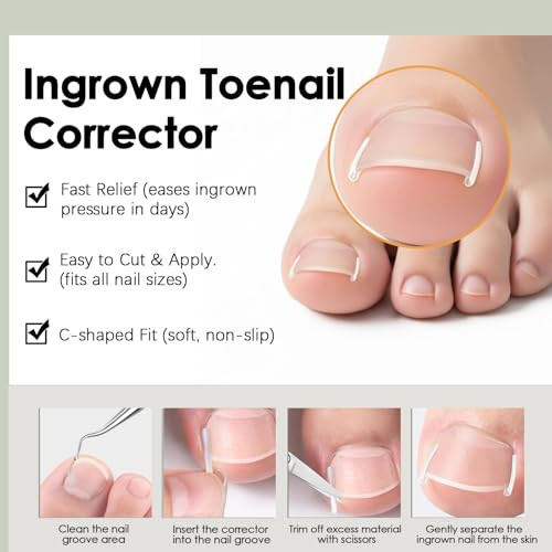Callmynm Ingrown Toenail Corrector Set Professional Ingrown Nail Treatment Kit With Breathable Correction Strips Curved Patches And Complete Pedicure Tool Set For Pain Relief And Healthy Nail Growth