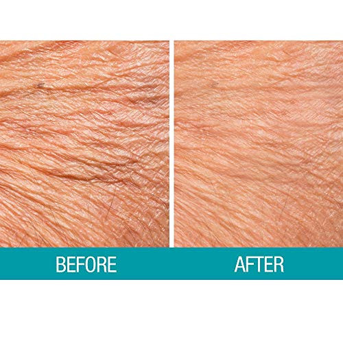 Dermactin Ts Crepe Be Gone Body Souffle 3 Ounce (2-Pack)