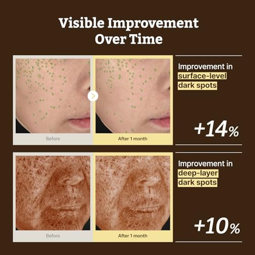 Dr.Reju-All Dr. Reju-All Advanced Retino-Mela Serum Hpr Retinol Serum For Face Anti-Aging Pore Minimizer Next-Gen Korean Skin Care Gentle & Beginner-Friendly Niacinamide 10% & Txa 4% 1 Fl Oz