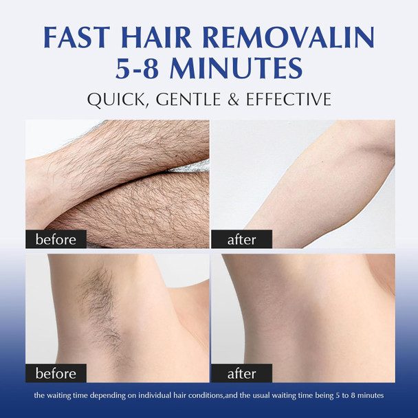 Expressions Wellness Hair Removal Cream For Women And Men: Sensitive Body Depilatory Cream For Bikini Line Underarms & Legs With Scraper - Gentle Soothing Formula For All Skin Types 5.28 Fl Oz