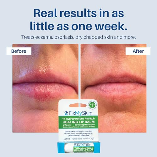 Fixmyskin 1% Hydrocortisone Healing Lip Balm Unflavored Soothes Dry Cracked & Irritated Lips Relieves Chapped Lips Cold Sores & Eczema Dermatologist Developed Travel-Friendly Tube 0.15 Oz