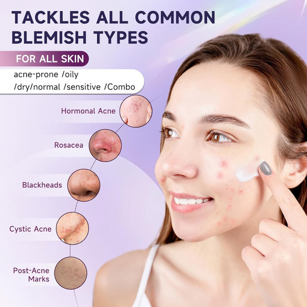 Kempc Cystic Acne Treatment For Face Hormonal Acne Spot Treatment Pimple Cream With Azelaic Acid | Redness Reducing Acne Moisturizer For Rosacea & Sensitive Acne-Prone Skin | Teens & Adults 1.7 Oz