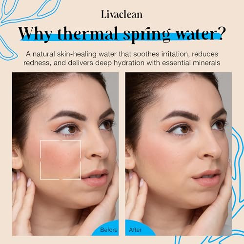 Livaclean 300Ml + 50Ml Thermal Spring Water Face Spray Mist Hydrating W/ Hyaluronic Acid & Aloe Vera - Hydrating Face Mist Soothing & Calming Mineral-Rich Skin Nourishment Refreshing 10 Fl Oz + 1.7 Fl Oz