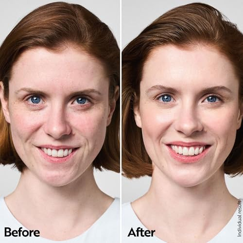 M. Asam Aqua Intense Hyaluron Night Cream (1.7 Fl Oz) Rich Face Moisturizer With Hyaluronic Acid Intensive Overnight Face Cream For Deep Hydration Smooth Skin And Long Lasting Moisturizer Care