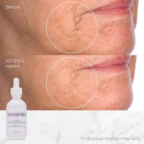 Nassifmd Niacinamide Serum 10% With Cranberry Biopeptides And Ectoin Brightening And Hydrating Vitamin B3 Face Serum Evens Tone Smooths Texture Reduces Fine Lines Boosts Radiance