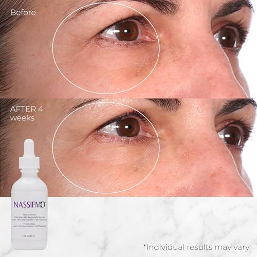 Nassifmd Niacinamide Serum 10% With Cranberry Biopeptides And Ectoin Brightening And Hydrating Vitamin B3 Face Serum Evens Tone Smooths Texture Reduces Fine Lines Boosts Radiance